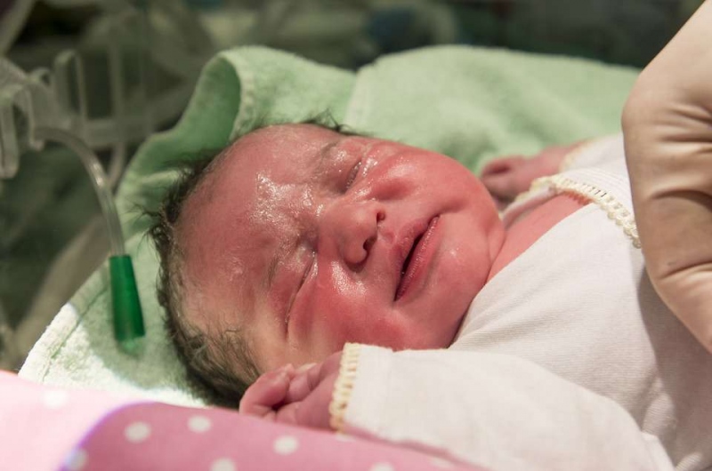 产前重度窒息的新生儿表现新生儿窒息的抢救方法