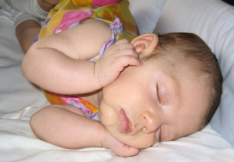 婴儿化脓中耳炎严重吗婴儿化脓中耳炎有哪些典型症状
